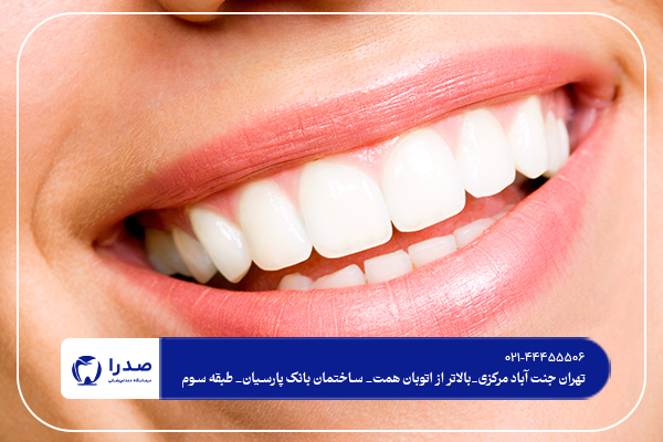 بهترین روش سفید کردن دندان بهترین روش سفید کردن دندان