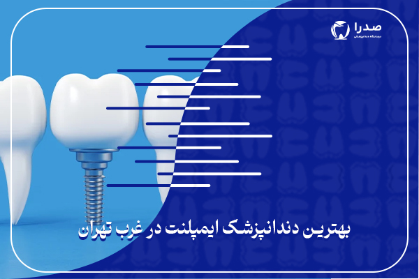 بهترین دندانپزشک ایمپلنت در غرب تهران