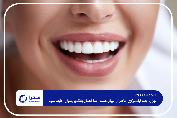بهترین دندانپزشک ایمپلنت در غرب تهران