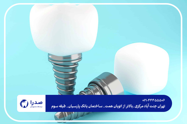 بهترین دندانپزشک ایمپلنت در غرب تهران