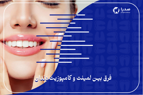 فرق بین لمینت و کامپوزیت دندان