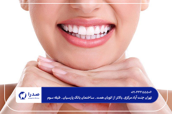 فرق بین لمینت و کامپوزیت دندان فرق بین لمینت و کامپوزیت دندان