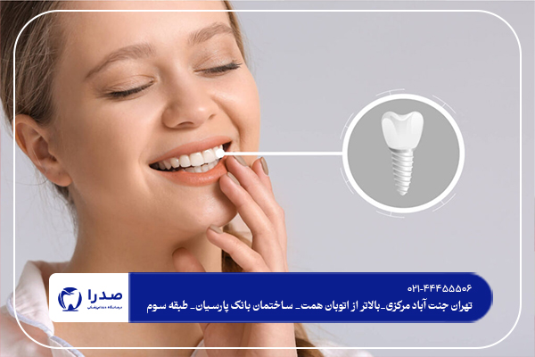 آیا ایمپلنت دندان درد دارد؟ آیا ایمپلنت دندان درد دارد؟