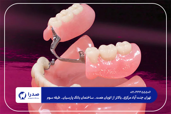 ایمپلنت به صرفه تر است یا دندان مصنوعی؟