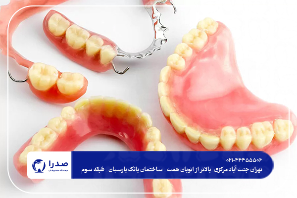 ایمپلنت به صرفه تر است یا دندان مصنوعی؟