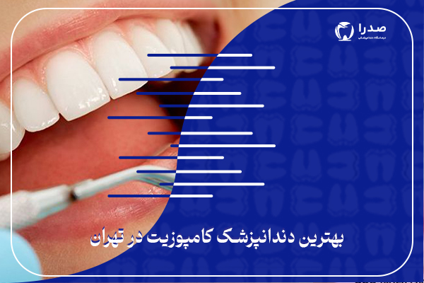 بهترین دندانپزشک کامپوزیت در تهران