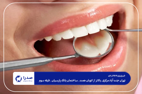 بهترین دندانپزشک کامپوزیت در تهران