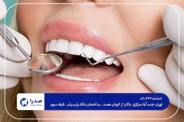 بهترین دندانپزشک کامپوزیت در تهران