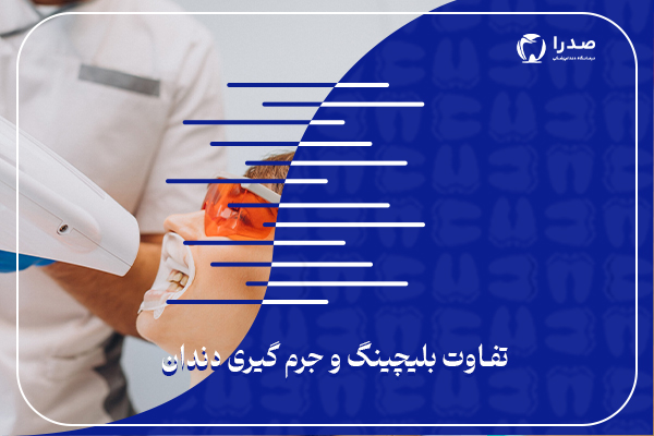 تفاوت بین بلیچینگ وجرم گیری دندان
