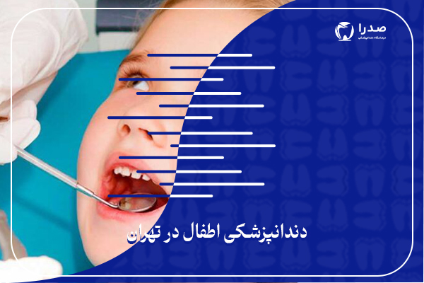 دندان پزشکی اطفال در تهران