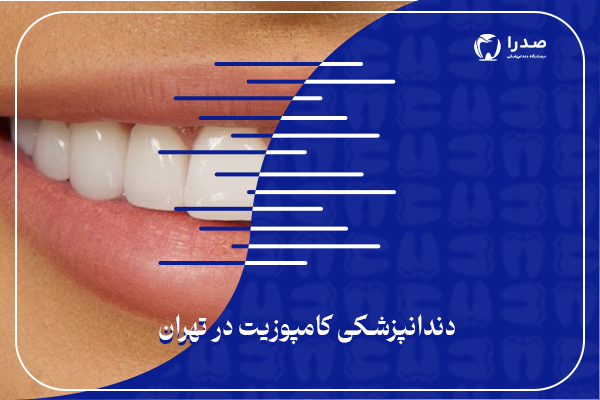 دندانپزشکی کامپوزیت در تهران دندانپزشکی کامپوزیت در تهران