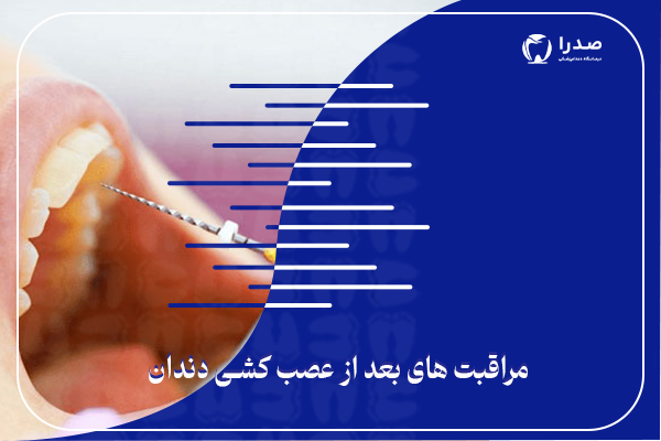 مراقبت های بعد از عصب کشی دندان