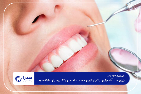 مزایای استفاده از ونیر