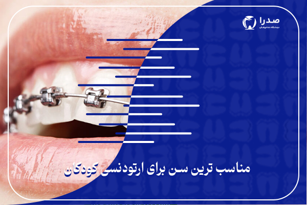 مناسب ترین سن برای ارتودنسی کودکان
