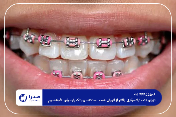 مناسب ترین سن برای ارتودنسی کودکان