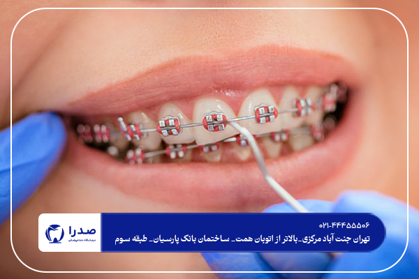 مناسب ترین سن برای ارتودنسی کودکان