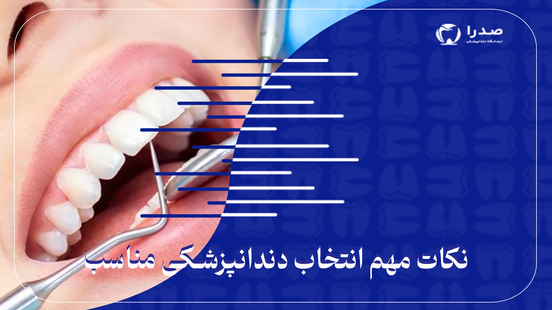 نکات مهم انتخاب دندانپزشکی مناسب