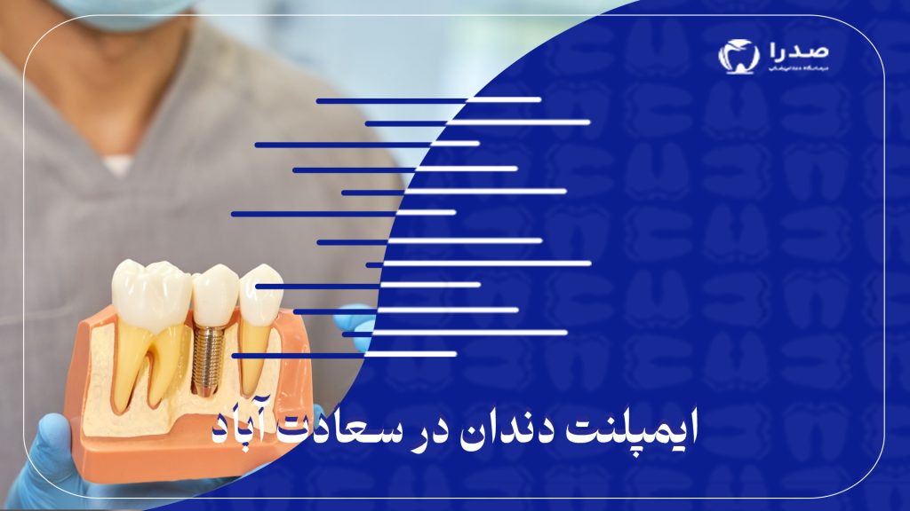 ایمپلنت دندان در سعادت آباد