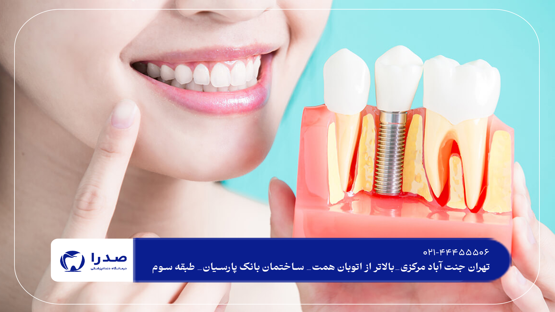 ایمپلنت دندان در سعادت آباد