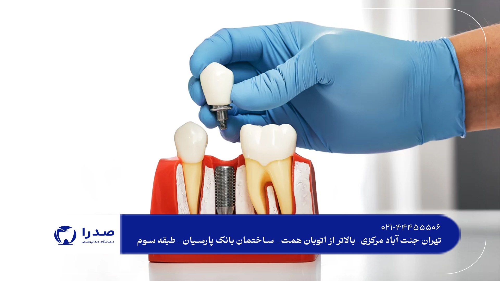 ایمپلنت دندان در سعادت آباد