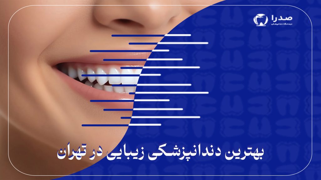 بهترین دندانپزشکی زیبایی در تهران