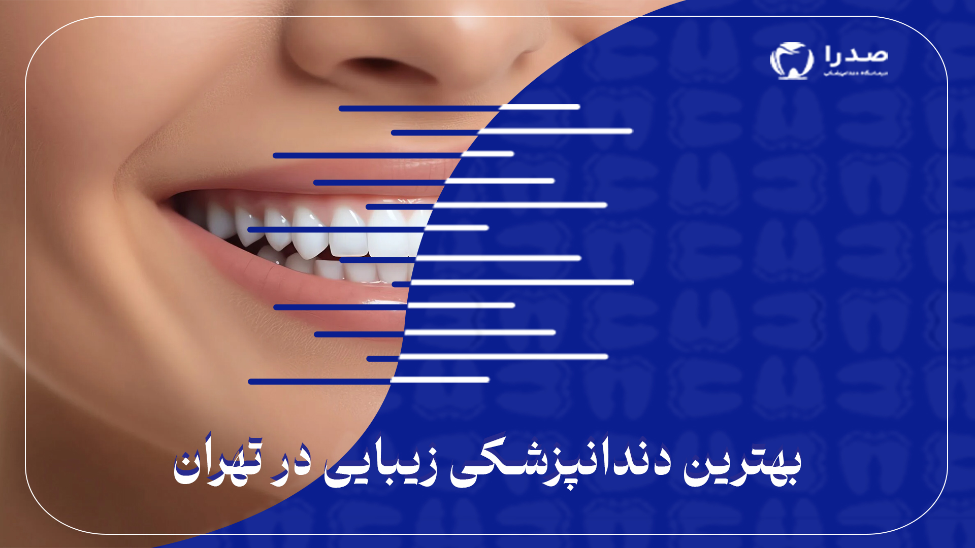 بهترین دندانپزشکی زیبایی در تهران
