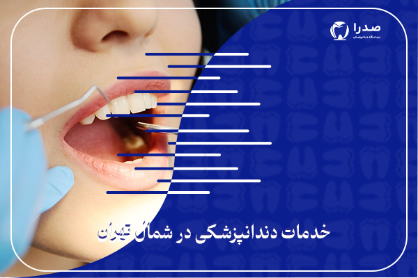 خدمات دندانپزشکی در شمال تهران