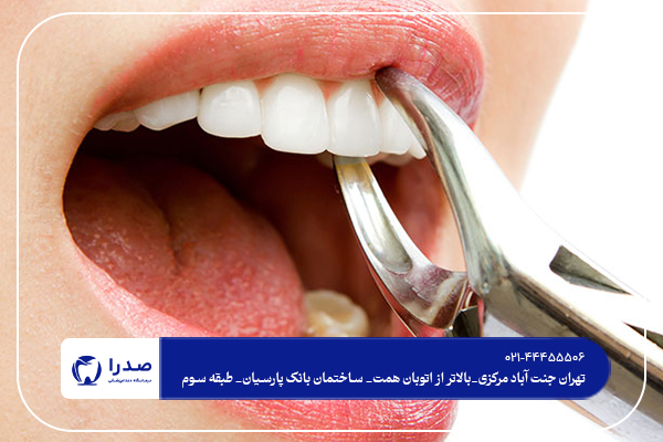 خدمات دندانپزشکی در شمال تهران