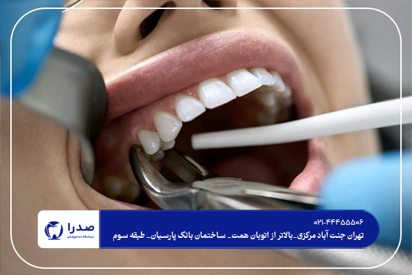 خدمات دندانپزشکی در شمال تهران