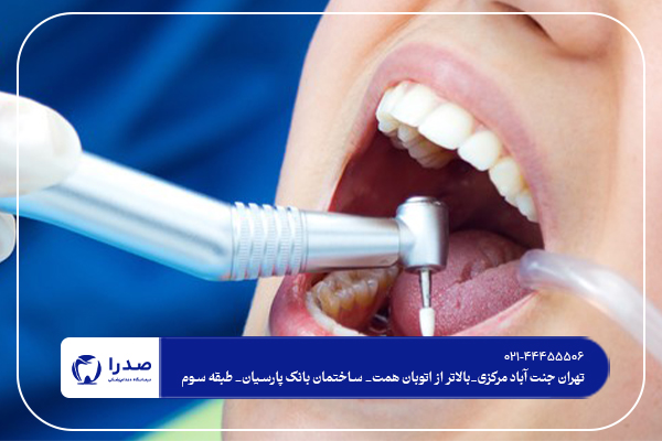 خدمات دندانپزشکی در شمال تهران