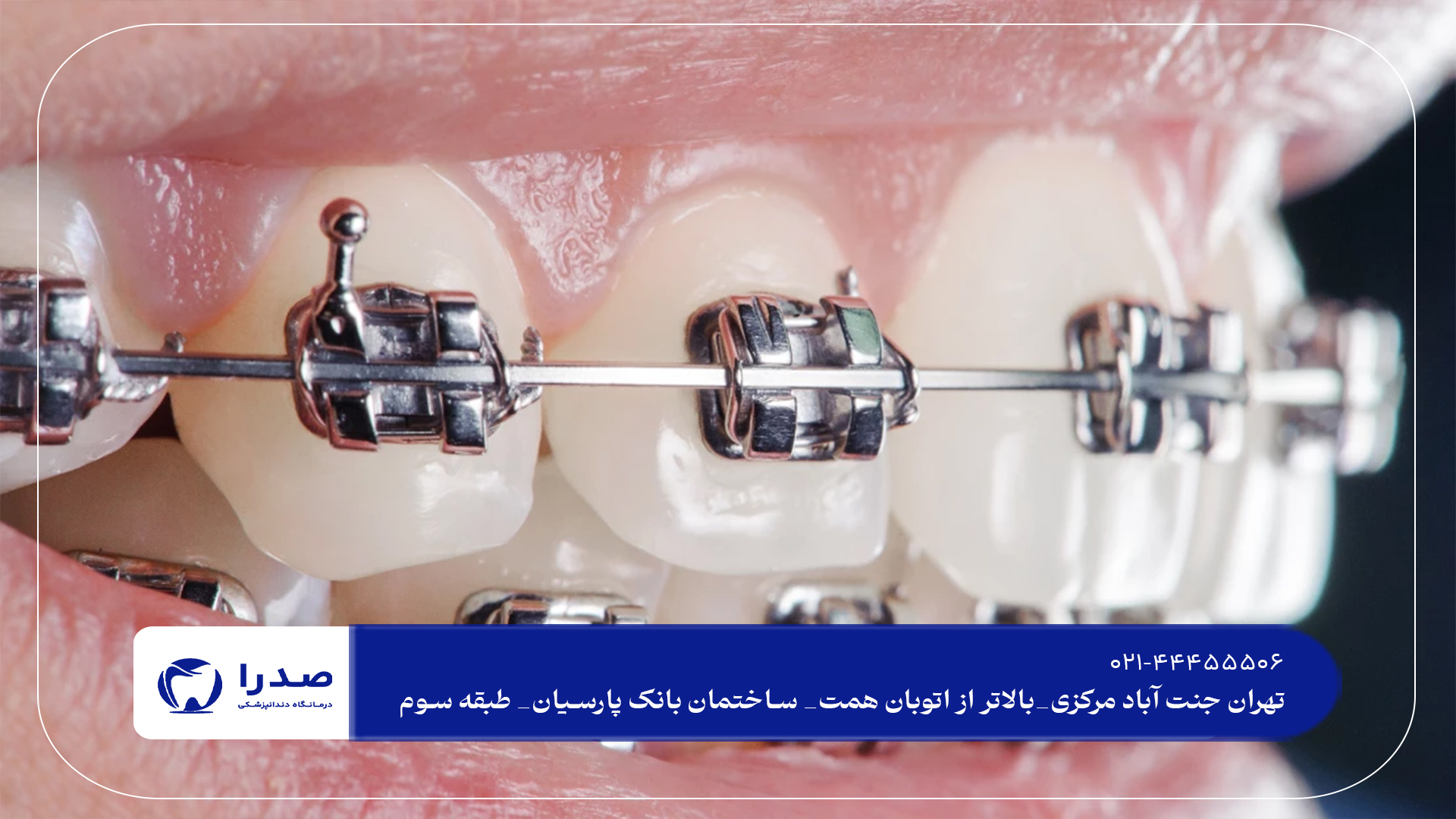 دندانپزشکی تخصصی ارتودنسی دندان