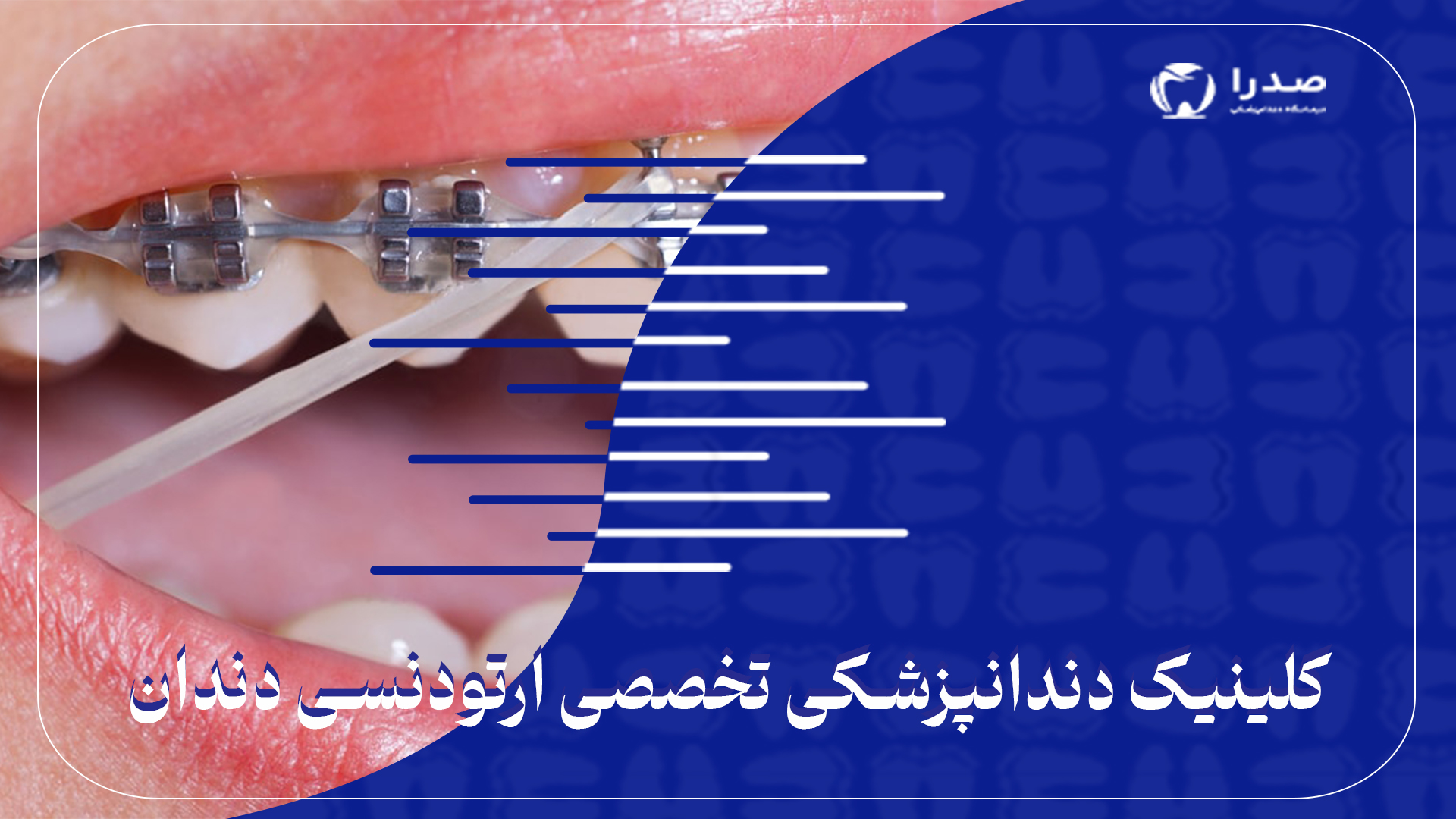 دندانپزشکی تخصصی ارتودنسی دندان
