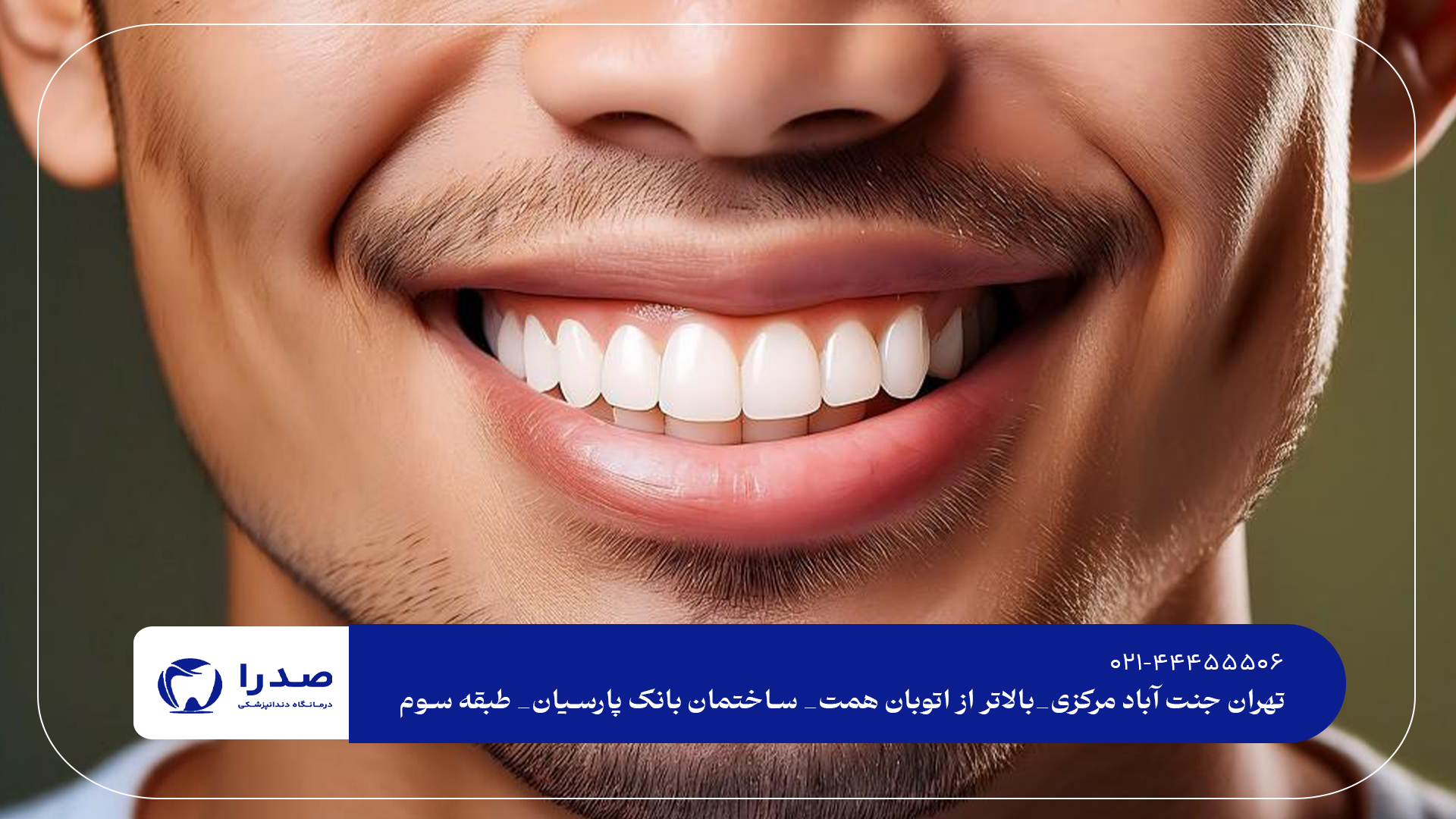 اصلاح طرح لبخند در تهران اصلاح طرح لبخند در تهران