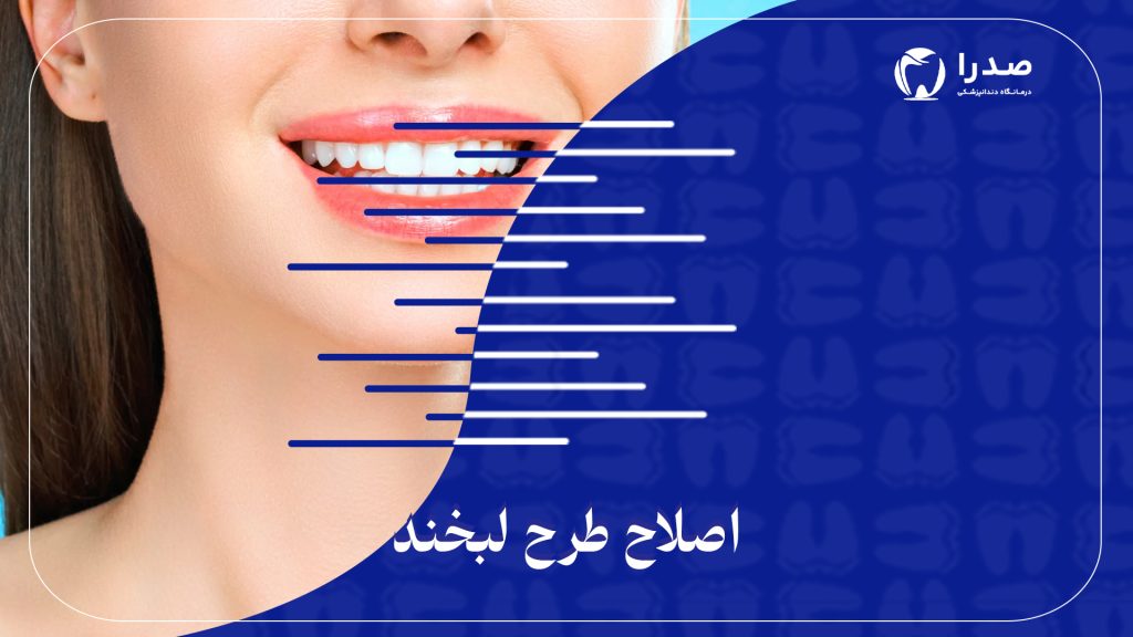 اصلاح طرح لبخند