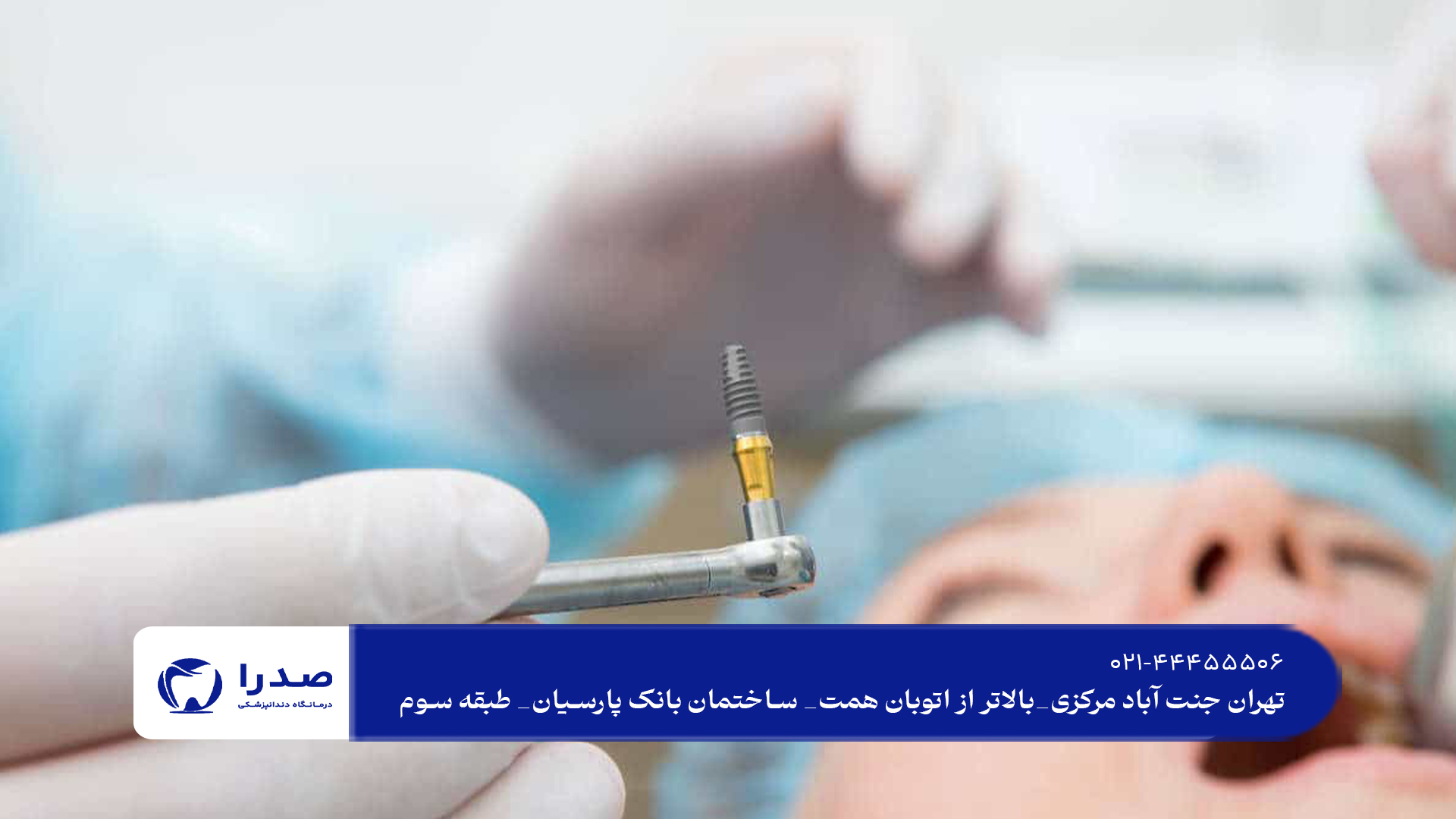 ایمپلنت دندان و مزایای آن