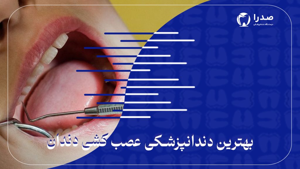 بهترین دندانپزشکی عصبکشی دندان