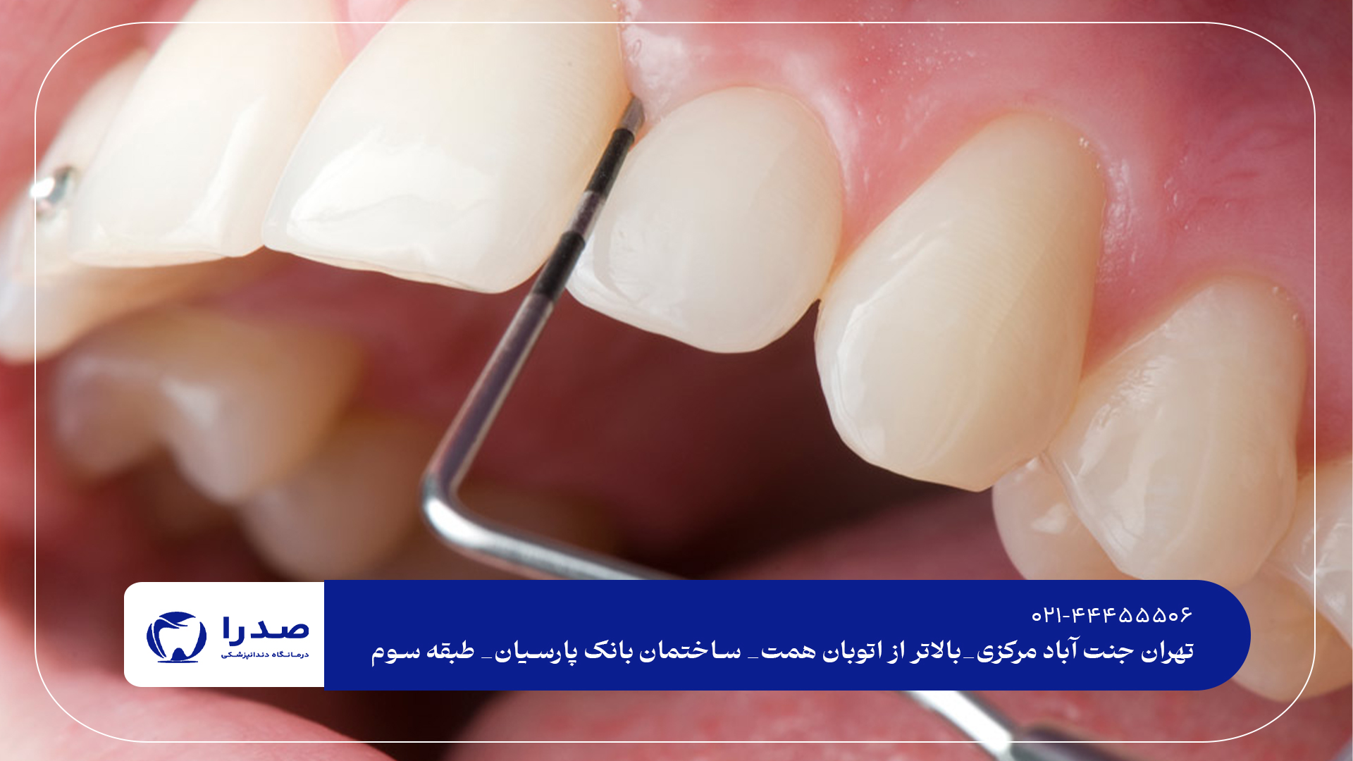 بهترین دندانپزشکی عصبکشی دندان بهترین دندانپزشکی عصبکشی دندان