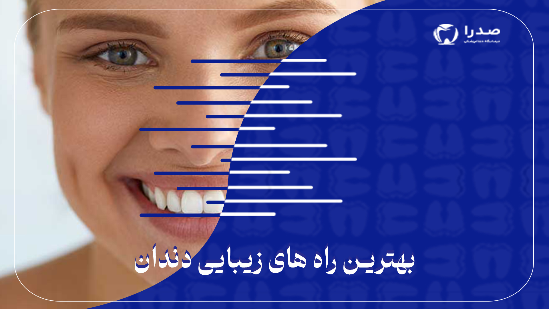 بهترین راههای زیبایی دندان بهترین راههای زیبایی دندان