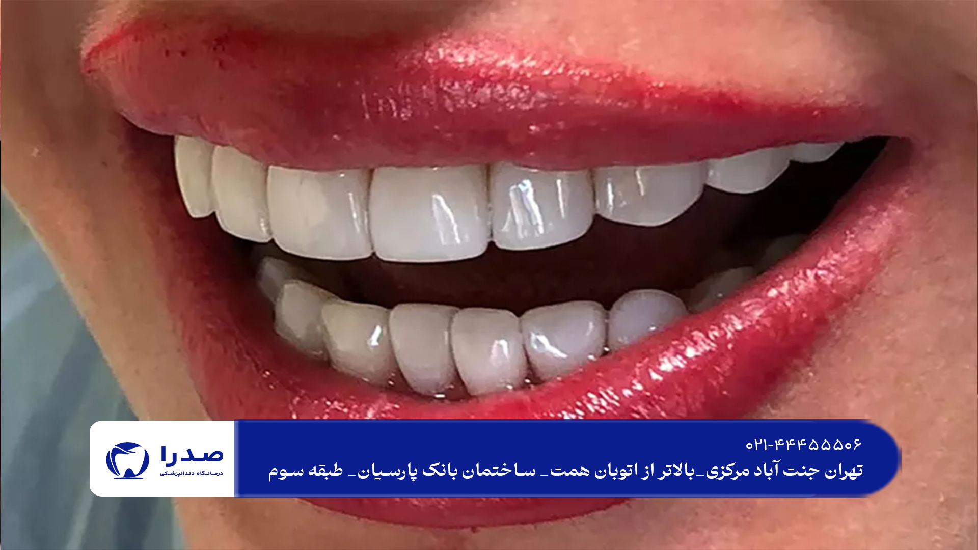 بهترین راههای زیبایی دندان بهترین راههای زیبایی دندان