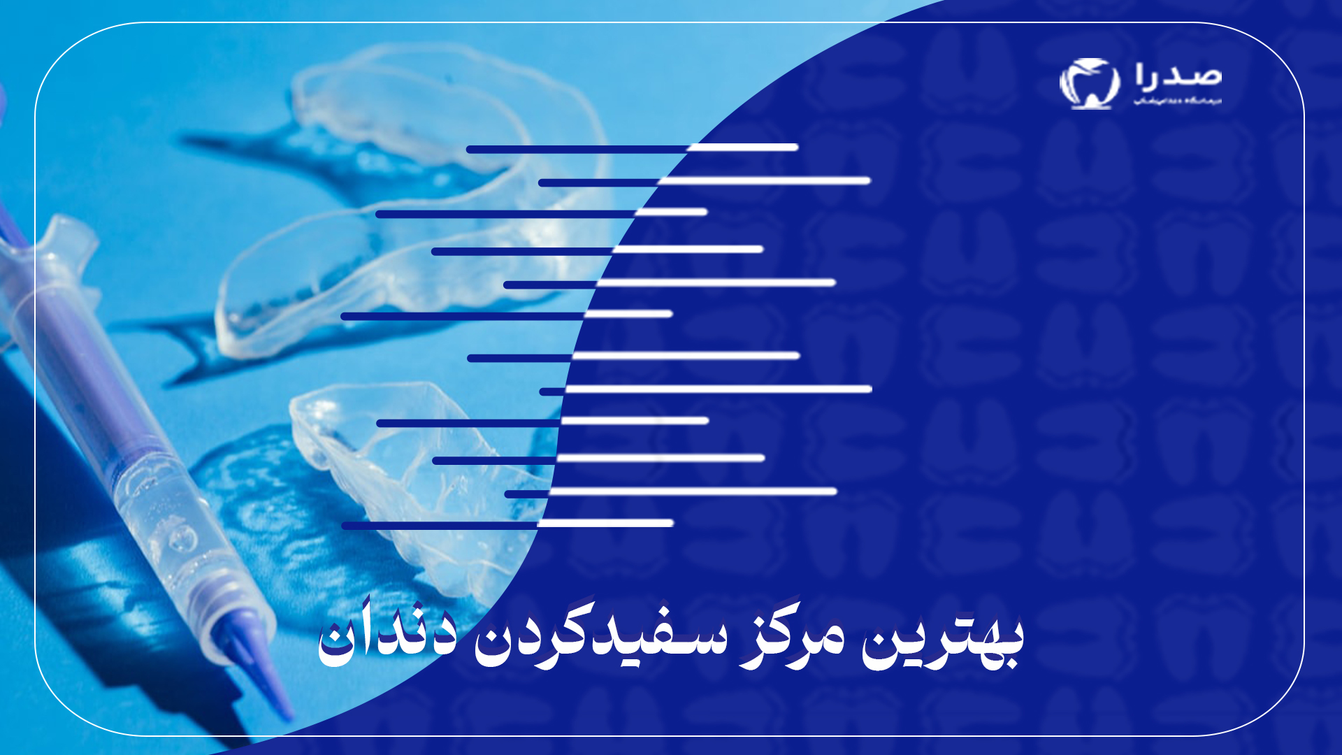 بهترین مرکز سفید کردن دندان بهترین مرکز سفید کردن دندان