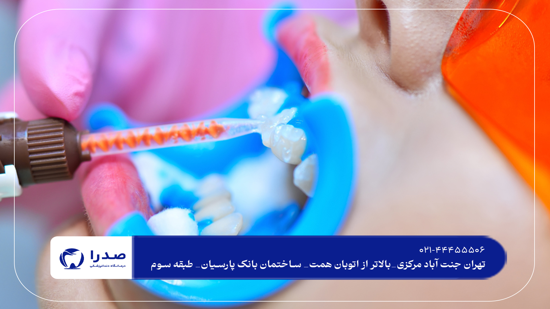 بهترین مرکز سفید کردن دندان بهترین مرکز سفید کردن دندان