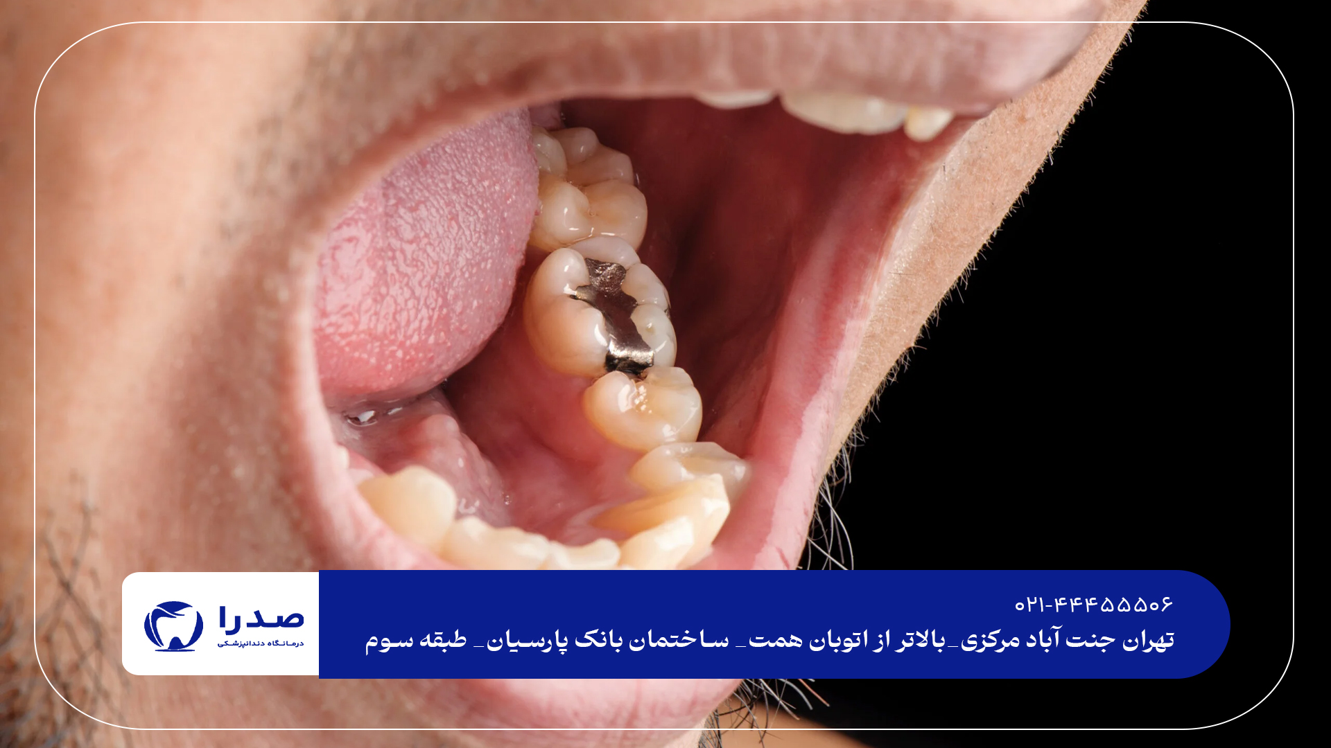 دندانپزشک متخصص در تهران