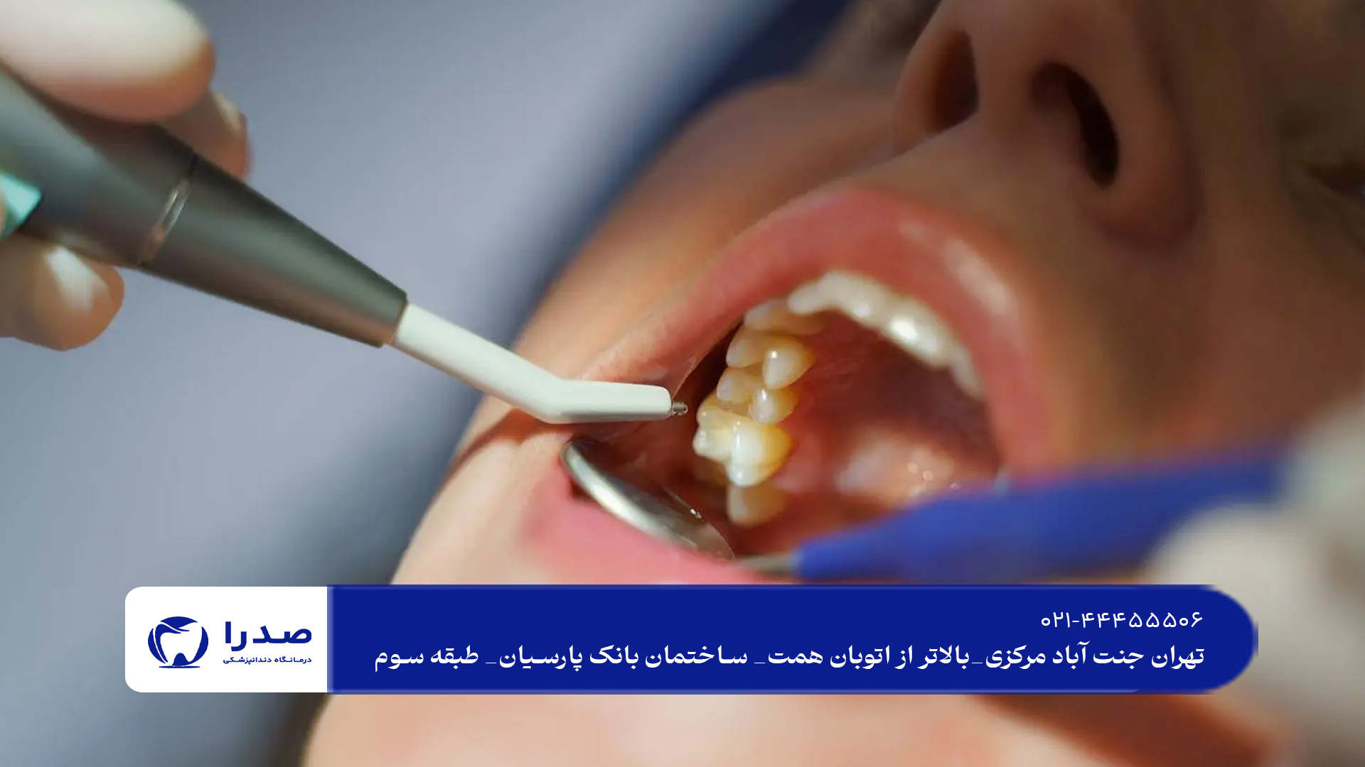 بهترین دندانپزشکی زیبایی در شمال تهران بهترین دندانپزشکی زیبایی در شمال تهران