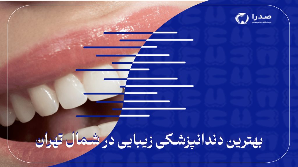 بهترین دندانپزشکی زیبایی در شمال تهران