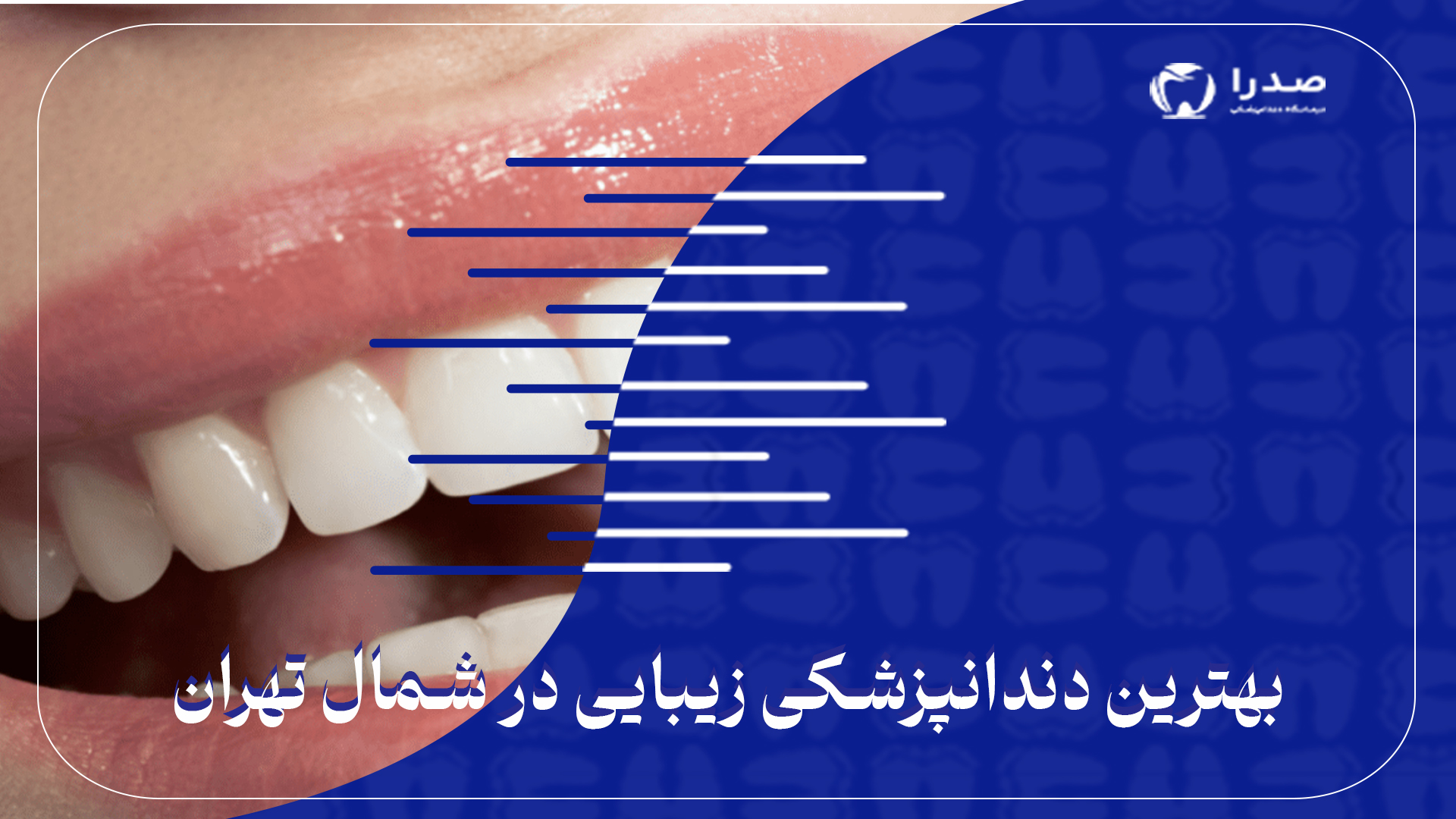 بهترین دندانپزشکی زیبایی در شمال تهران بهترین دندانپزشکی زیبایی در شمال تهران