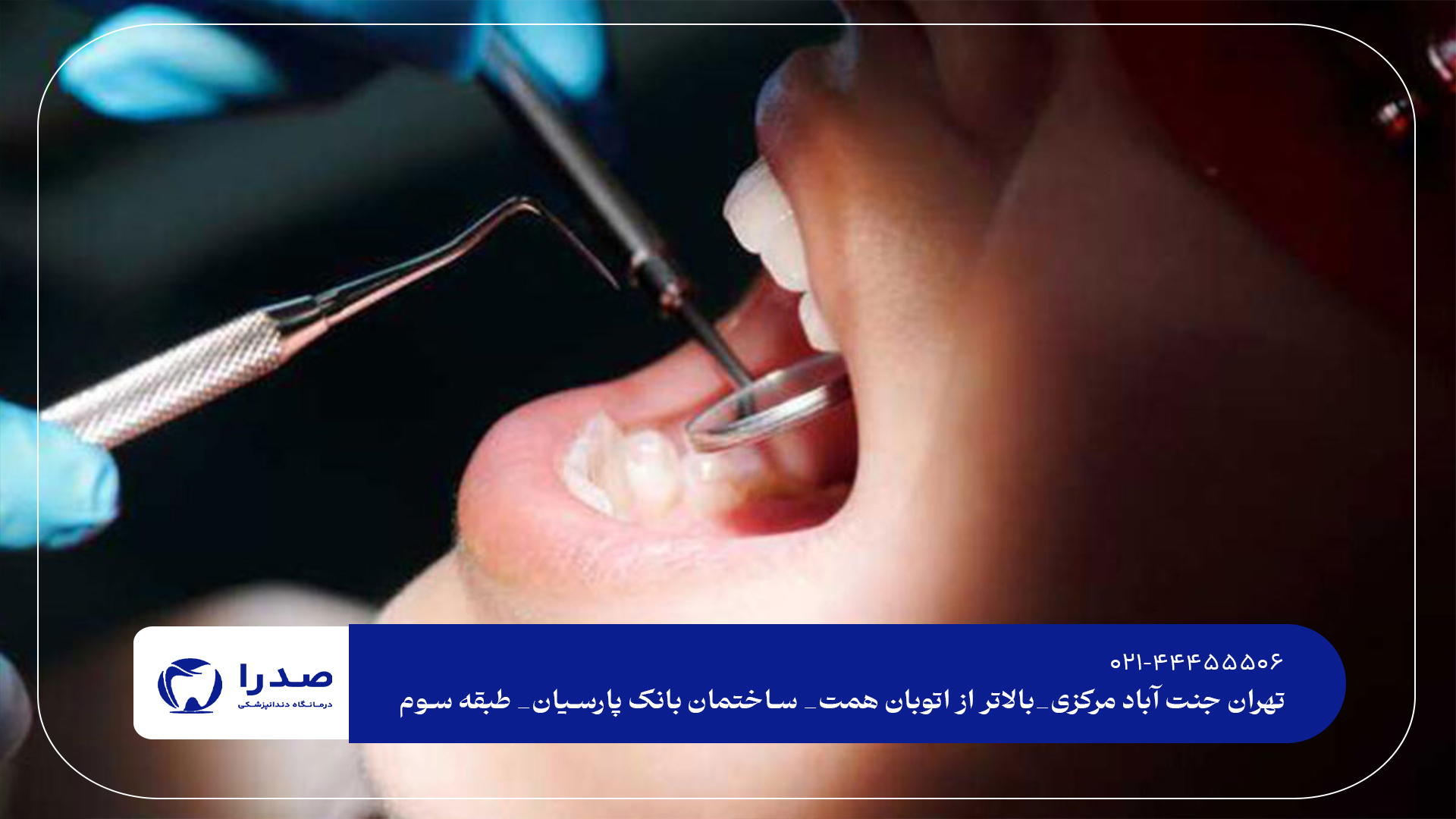 درمان دندان بدون درد در تهران درمان دندان بدون درد در تهران