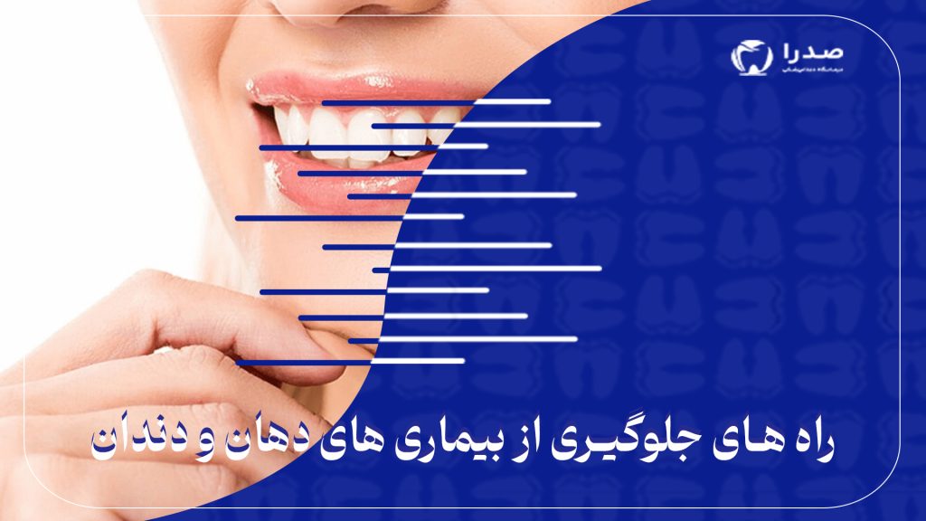 راه های جلوگیری از بیماری های دهان و دندان