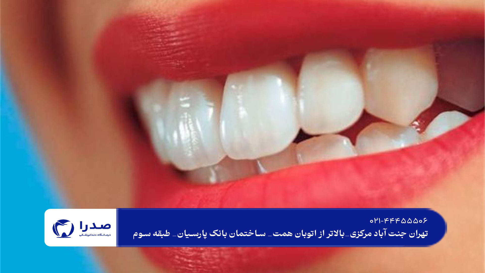 راه های جلوگیری از بیماری های دهان و دندان راه های جلوگیری از بیماری های دهان و دندان