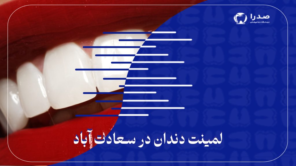 لمینت دندان در سعادت آباد