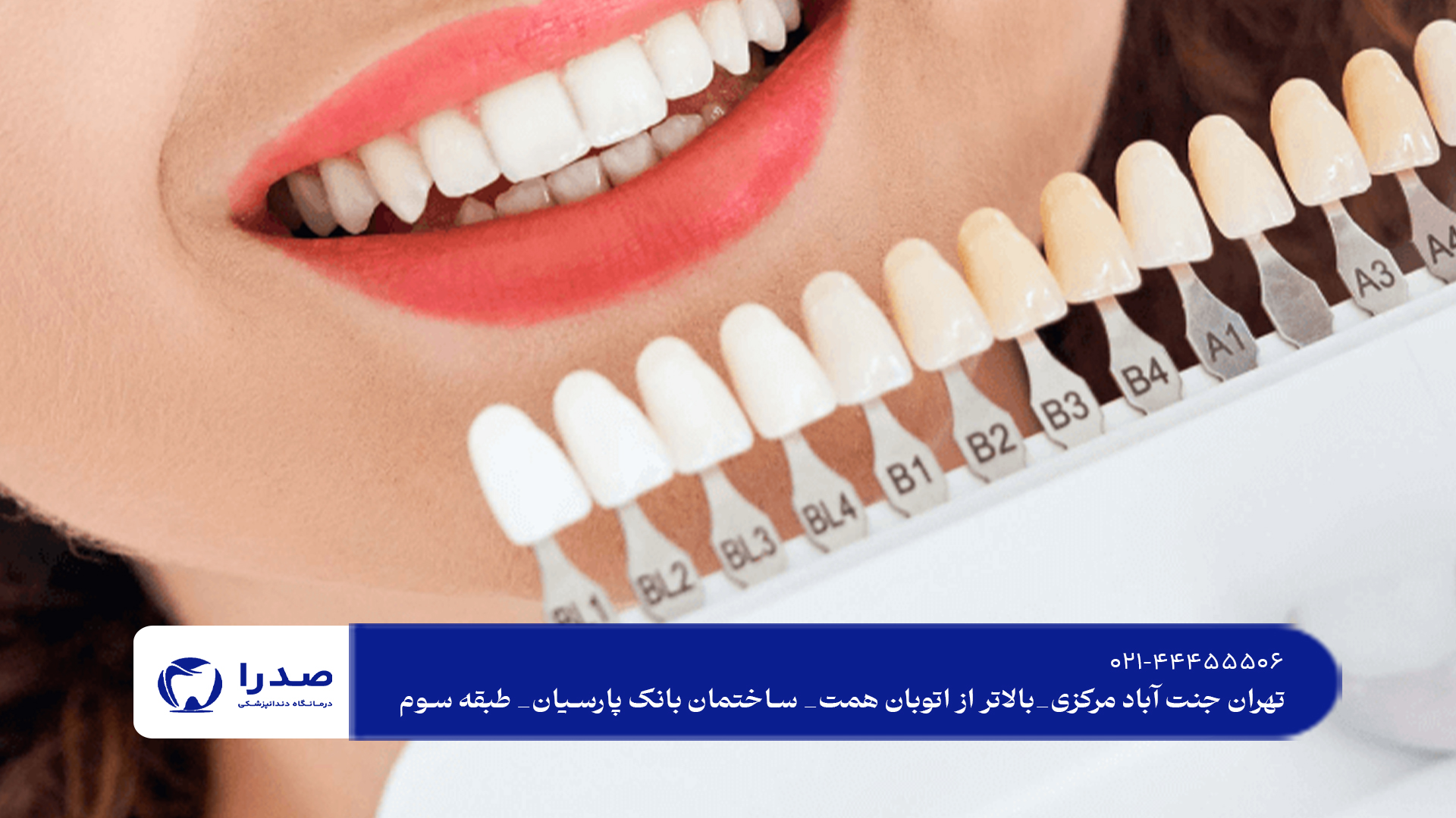 لمینت دندان در سعادت آباد